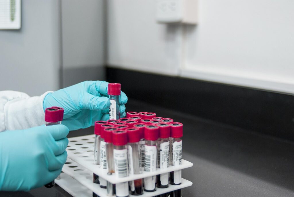 Lab technician handling blood specimen tubes, the kind of cargo moved under medical and government courier contracts
